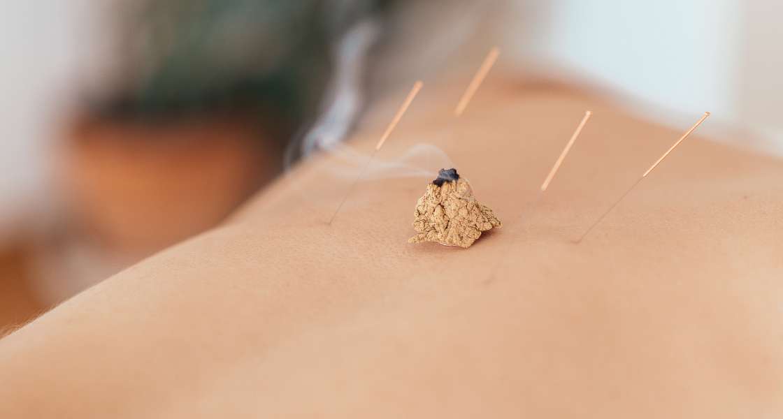 Moxibustion for depression