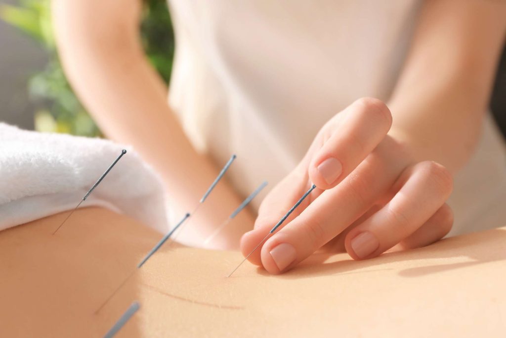 Relief of chronic pain symptoms with acupuncture treatment