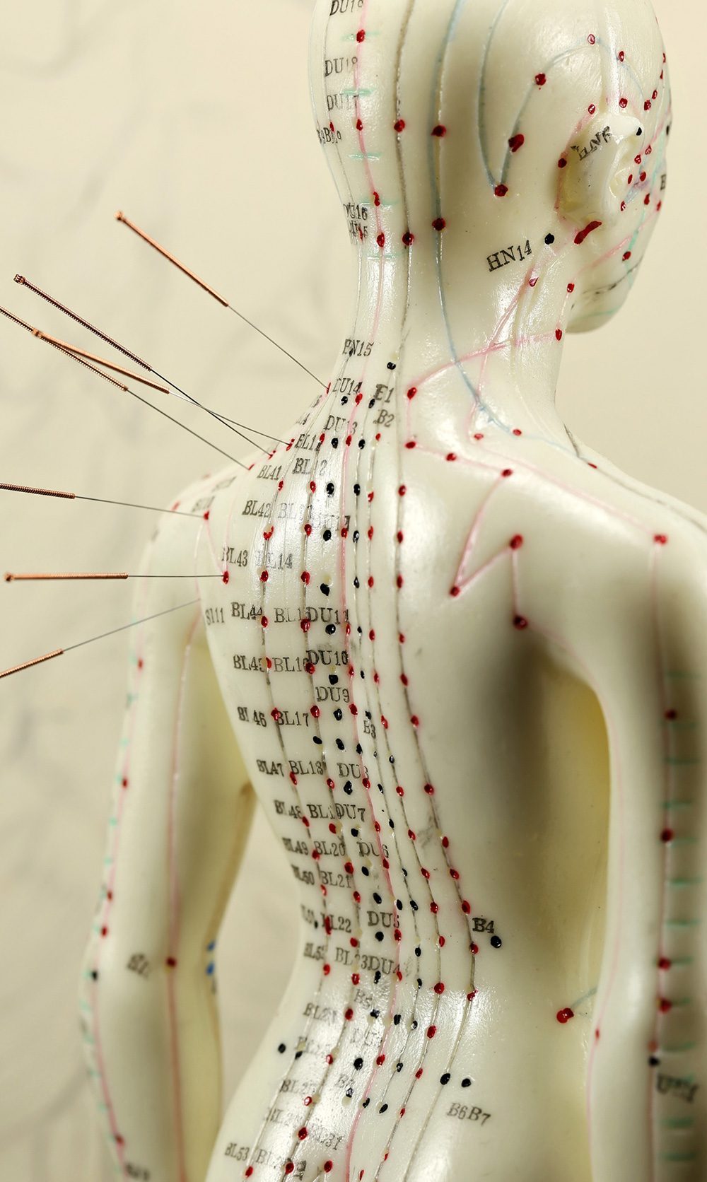 Our Services Acupuncture Therapy & Treatments Christchurch